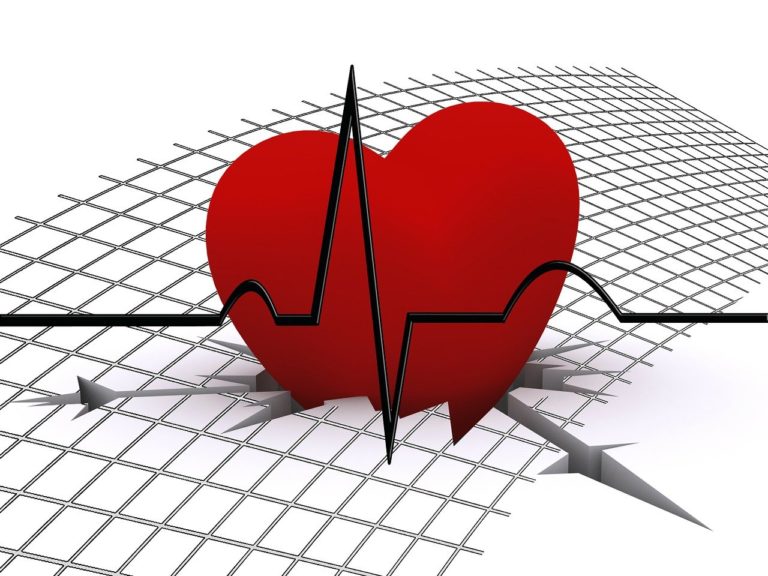 Cardiovascular health – must have supplements for those who have problems