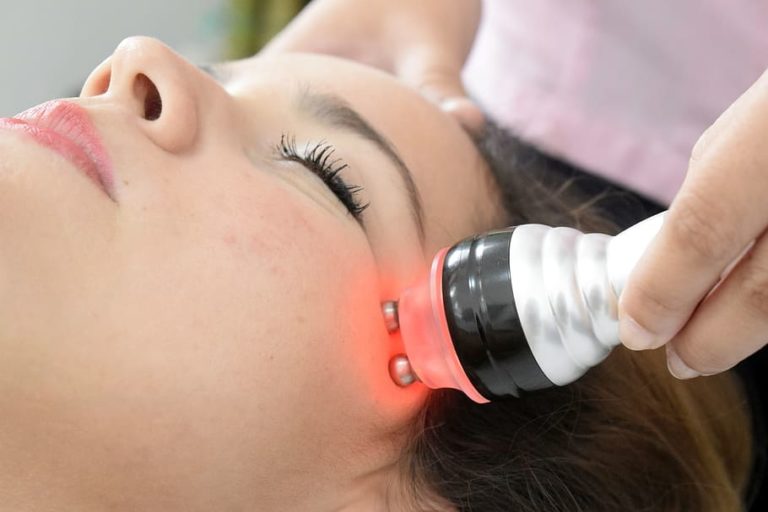 Laser acne treatment can help fight wrinkles